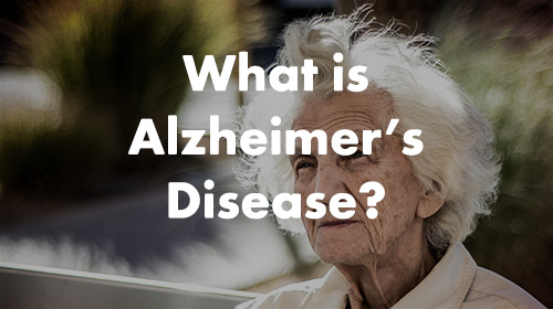 مراحل مختلف بیماری آلزایمر